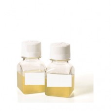 Anti-Human Chorionic Gonadotropin Beta Monoclonal Antibody