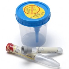 BD Vacutainer Urine Collection System