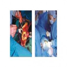 Blue Theca Plating Technology - Surgical Light