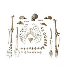 Disarticulated Skeleton