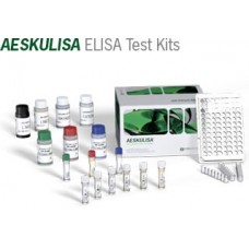Ttg Iga New Generation / Ttg Igg New Generation Elisa