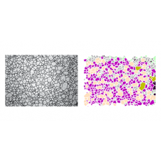 Grain Size Analysis