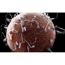 Intra Uterine Insemination