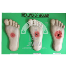 Wound Healing Model