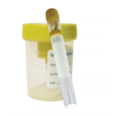 Vacuum Type Urine Transfer Container