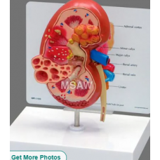 Human Kidney Model