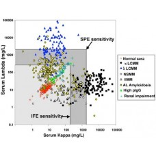 Serum Freelight Chain Assay