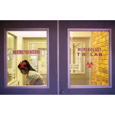 TB Lab