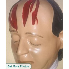 Vertebral Lumbers Dissected