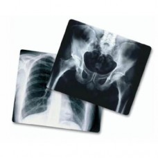 X Ray Films